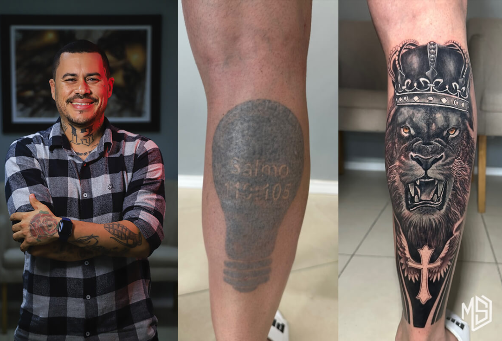 Reformas e Coberturas de Tatuagens